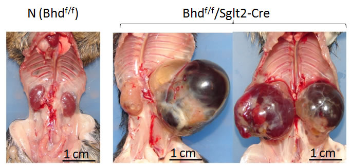 Bhd-Sglt2-cre phenotype